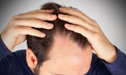 Erkeklerde Saç Dökülmesi Nasıl Önlenir ve Tedavi Edilir?