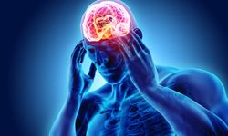 Migren nedir? Migren tedavisi? Migren belirtileri?